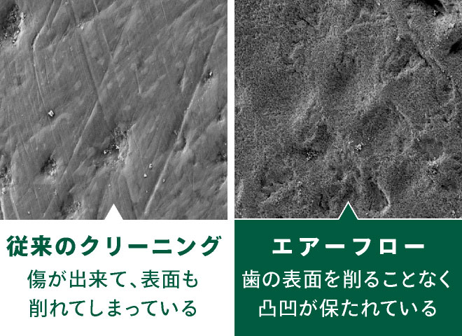 従来のクリーニングとエアフローの比較