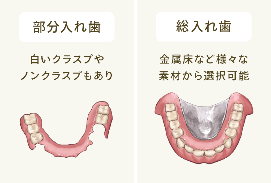 部分入れ歯：白いクラスプやノンクラスプもあり/総入れ歯：金属床など様々な素材から選択可能