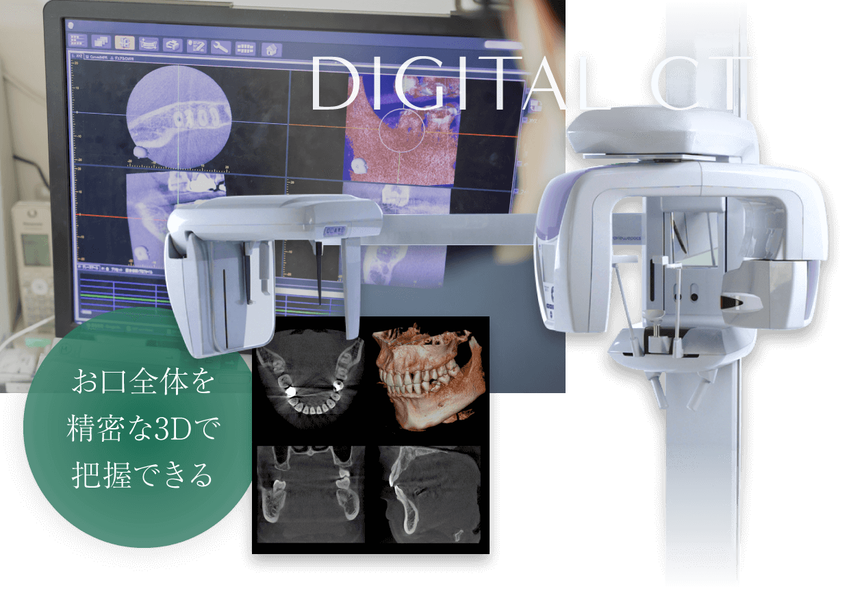 デジタルCT お口全体を精密な3Dで把握できる