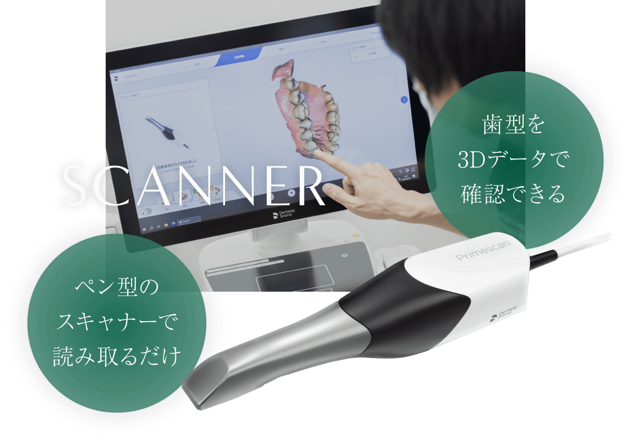 スキャナー ペン型のスキャナーで読み取るだけ/歯型を3Dデータで確認できる