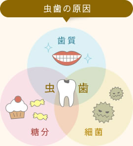 むし歯の原因「歯質」「細菌」「糖分」