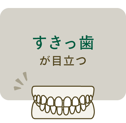 すきっ歯が目立つ