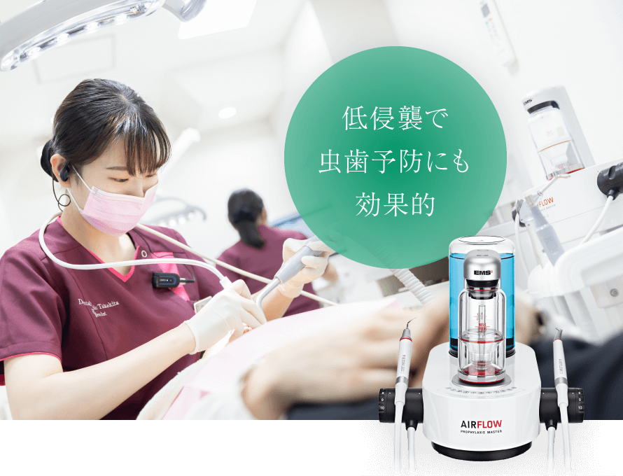 低侵襲で虫歯予防にも効果的